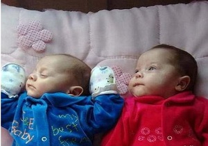 تولد معجزه آسای دو قلو‌ها با وجود مرگ مغزی مادر