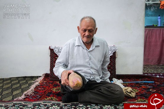 گزارشی تکان&zwnj;دهنده از شهرک جذامی&zwnj;های مشهد + عکس