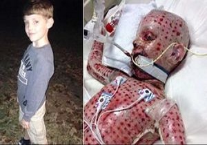 نجات معجزه‌آسای یک پسربچه از بیماری کشنده