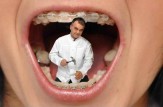 باشگاه خبرنگاران -ارتودنسی با دندان‌ها چه می‌کند؟ +فیلم