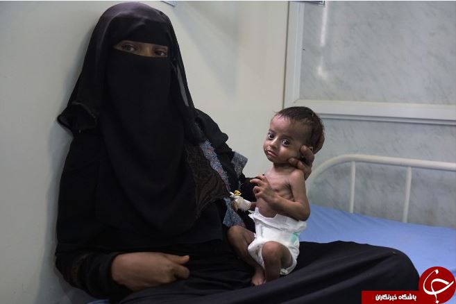 سی&zwnj;ان&zwnj;ان: آنچه عربستان نمی خواهد جهان درباره&zwnj;ی جنگ خاموش یمن بداند+ تصاویر
