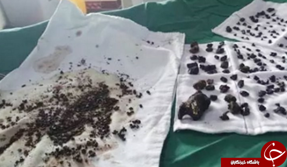 مهمانان ناخوانده ای که با نخوردن صبحانه به سرغتان می آیند+عکس