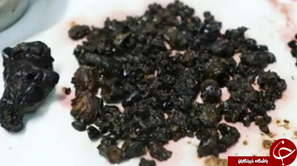 مهمانان ناخوانده ای که با نخوردن صبحانه به سرغتان می آیند+عکس