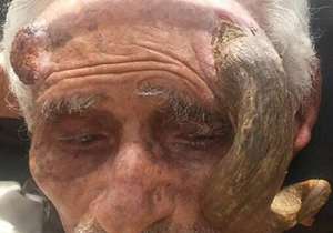 بریدن شاخ پیرمرد ۱۴۰ ساله موجب مرگش شد+فیلم