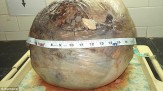 باشگاه خبرنگاران -بزرگترین غده تاریخ از رحم زنی 40 ساله بیرون کشیده شد +تصاویر دلخراش