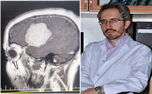 خارج کردن تومور ۶ سانتی متری از مغز یک بیمار خارج کردن تومور ۶ سانتی متری از مغز یک بیمار