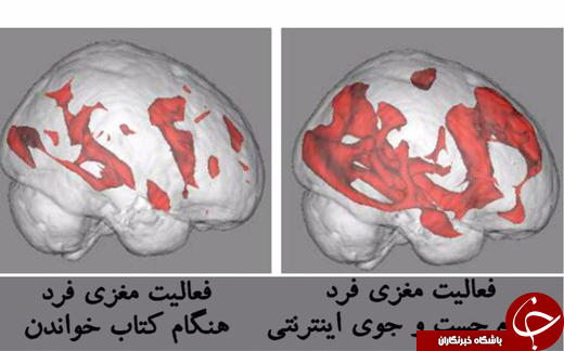 اینترنت چه بلایی سر مغز می&zwnj;آورد؟ +عکس