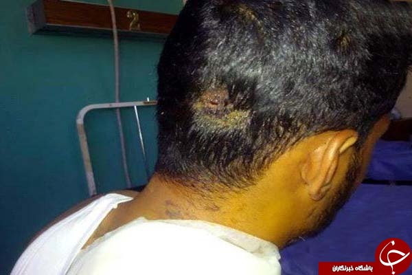 روایت رزمنده عراقی از نجات معجزه آسا از دست داعش+عکس