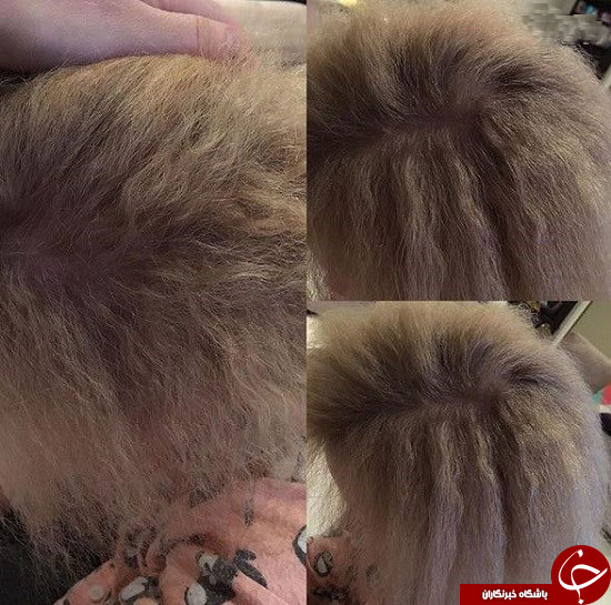 دختر ۷ ساله مبتلا به سندروم موهای شانه نشدنی دختر ۷ ساله مبتلا به سندروم موهای شانه نشدنی