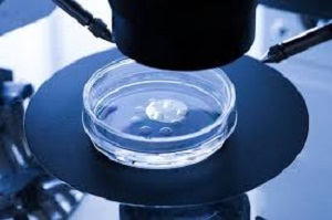 افزایش ۲۰ در صدی IVF درمرکز درمان ناباروری استان مرکزی