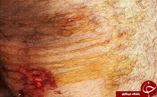 حمله خرس به دو مرد روستایی +تصاویر