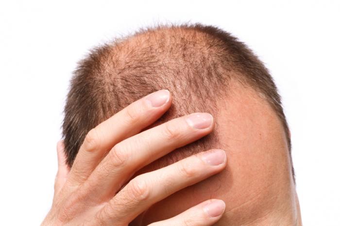 راهکار&zwnj;های مراقبتی از مو&zwnj;های تاب دار در هوای گرم تابستانی....مو&zwnj;های فر در معرض ریزش شدید در فصل گرما....قابل توجه افرادی که موی فردارند؛ ریزش مو در فصل تابستان را جدی بگیرید...