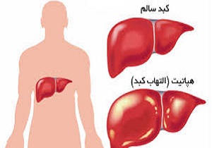 برپایی کمپین «بدون هپاتیت» در بیمارستان شهید بهشتی قم