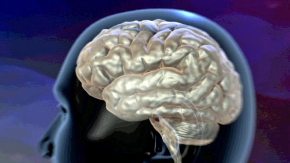 پیشگیری از آلزایمر با کشف مبدا بیماری