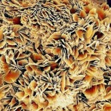 باشگاه خبرنگاران -نمای متفاوت از سنگ کلیه +عکس