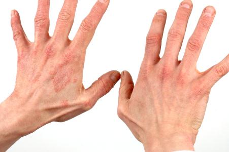 با این ترفند از خشکی پوست جلوگیری کنید/حمام طولانی مدت چه بلایی سرمان می آورد؟/این وعده غذایی کودک شما را زیبا می کند/چرا در خواب حرف می زنیم؟