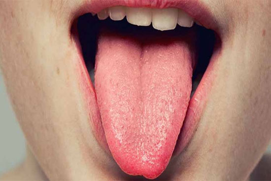 زبان&zwnj;تان به شما چه هشدارهایی درباره سلامتی تان می دهد؟