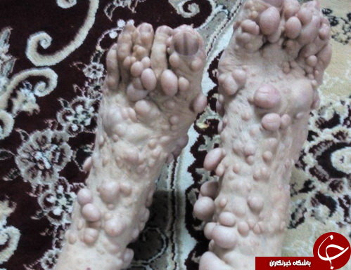 زجر روی صورت&zwnj;شان است +تصاویر (16+)