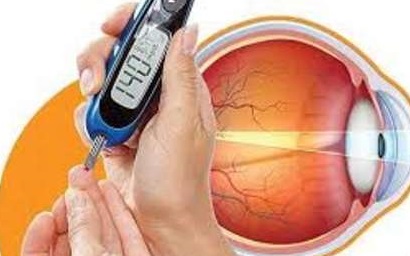 ۲۵ درصد دیابتی&zwnj;ها دچار اختلال بینایی می&zwnj;شوند