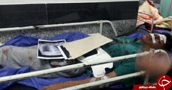 تصاویری از مجروحان حادثه سقوط تله کابین در بیمارستان