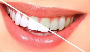 خوراکی هایی که باعث زرد شدن دندانهایتان می شوند+ اینفوگرافی
