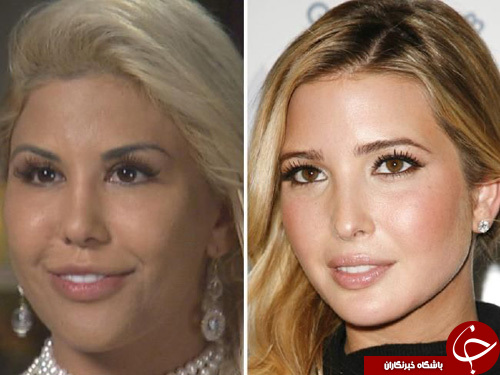 هزینه 40 تا 50 هزار دلاری برای شبیه شدن به ایوانکا+ تصاویر