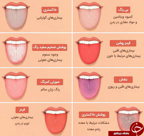 رنگ زبان خبر می&zwnj;دهد از سر درون +عکس