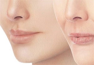 ۷ راهکار ساده طب سنتی برای &laquo;پُر شدن صورت&raquo;