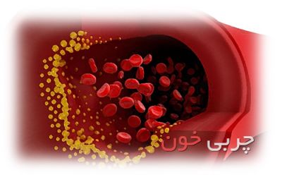 هشدار به افراد بالای ۲۰ سال: چربی خون خود را کنترل کنید