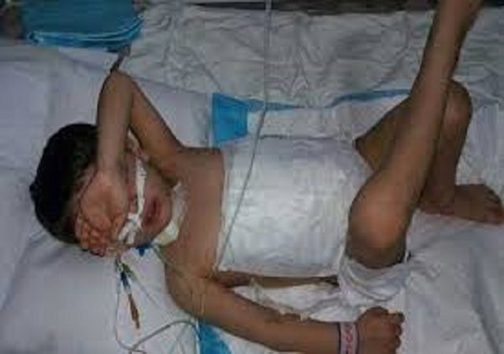 دریده شدن کودک 4 ساله در حمله سگ وحشی/خانه&zwnj;هایی که سرپناه نشدند/شعله های آتش همچنان جنگل می بلعند/مرگ دلخراش کارگر جوان در آتش سوزی عمدی