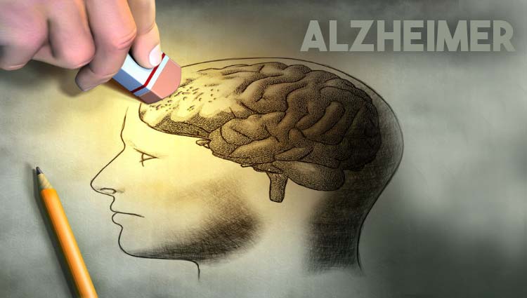 راه رفتن زیگزاگ و ضربدری جدیدترین شیوه مبارزه با آلزایمر+ تصاویر