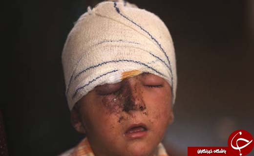 تصاویری تکان دهنده از زخم جنگ بر سر و صورت کودکان تلعفر