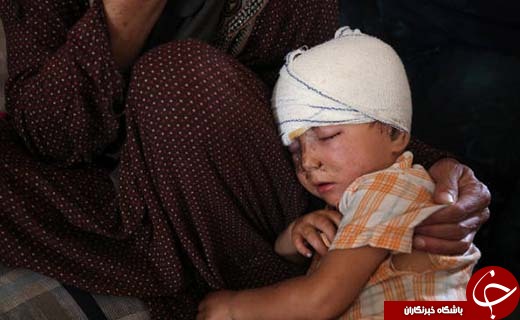 تصاویری تکان دهنده از زخم جنگ بر سر و صورت کودکان تلعفر
