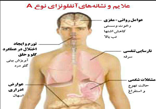 آنچه در مورد آنفولانزا باید در نظر گرفته شود