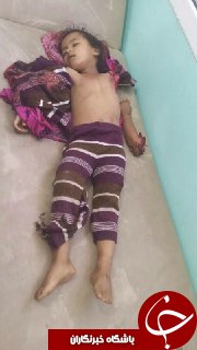 تصاویری هولناک از شهادت دختربچه یمنی در حمله هوایی سعودی&zwnj;ها