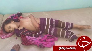 تصاویری هولناک از شهادت دختربچه یمنی در حمله هوایی سعودی&zwnj;ها