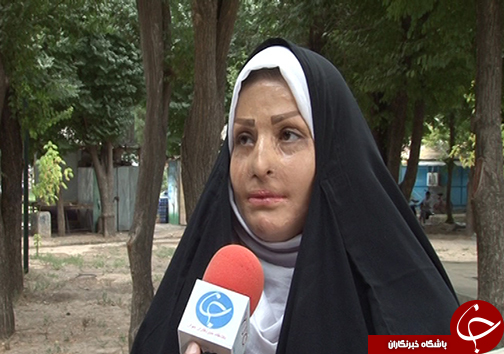 شمارش معکوس برای دانش آموزان سوخته مدرسه درودزن/ ۱۸ سالگی بهترین زمان برای جراحی پلاستیک دانش آموزان