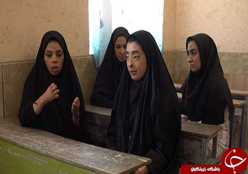 شمارش معکوس برای دانش آموزان سوخته مدرسه درودزن/ ۱۸ سالگی بهترین زمان برای جراحی پلاستیک دانش آموزان