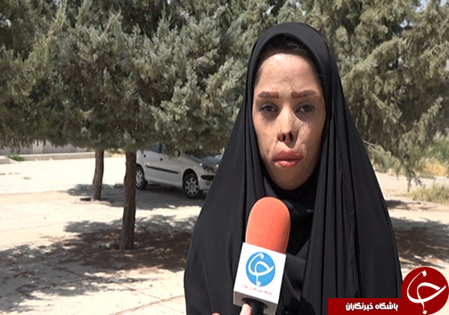 شمارش معکوس برای دانش آموزان سوخته مدرسه درودزن/ ۱۸ سالگی بهترین زمان برای جراحی پلاستیک دانش آموزان