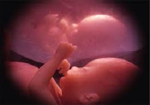 جدیدترین روش&zwnj;های درمان شکست مکرر IVF