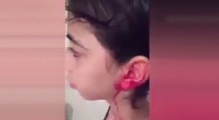 دختری که با گوش هاو بینی اش خون گریه می کند+فیلم