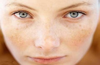 6 ترفند فوق العاده بدون نياز به هزينه برای داشتن پوستی صاف و بدون لک