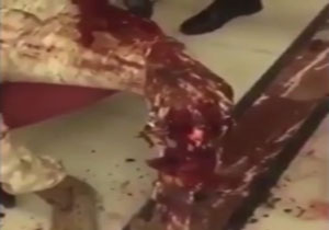 صحنه سازی دروغین رسانه‌های سعودی از زخمی شدن یک سرباز وظیفه در یمن + فیلم