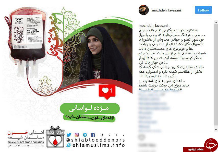 توصیه مجری مشهور به اهدای خون به جای قمه&zwnj;زنی در عزای امام حسین(ع)