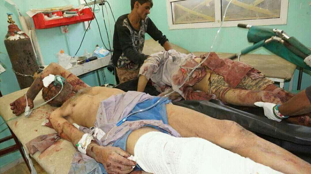 تصاویر هولناک از جنایات امروز جنگنده های سعودی علیه مردم بی دفاع صعده 18+