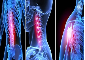 ناهنحاریهای عضلانی و اسکلتی را جدی بگیرید
