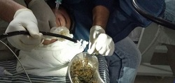 پسری که عاشق خوردن چوب و پلاستیک است