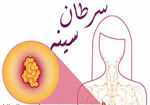 سرطان سینه بیشترین فراوانی را در زنان خراسان شمالی دارد