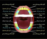 باشگاه خبرنگاران -راز پوسیدگی دندان‌ها در چیست؟ +عکس