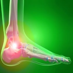 ۷ نقص رایج در پاها که ممکن است شما هم با آن درگیر باشید+ روش مقابله